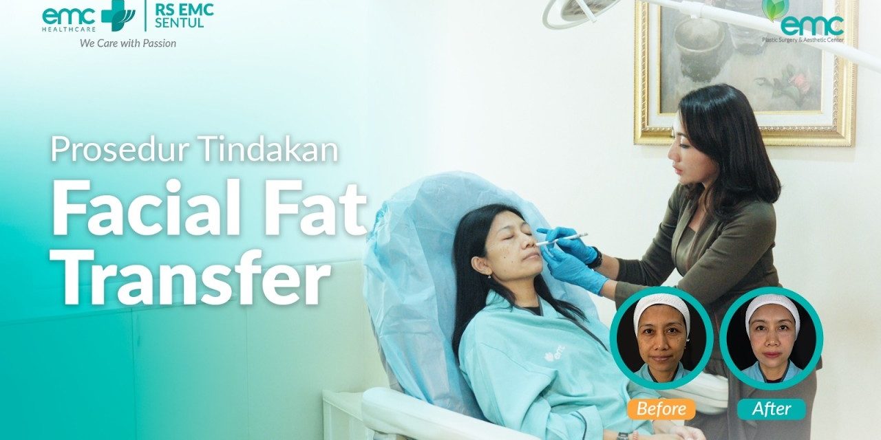Bukan Hanya Buang Lemak, Fat Transfer Ubah Investasi Estetik