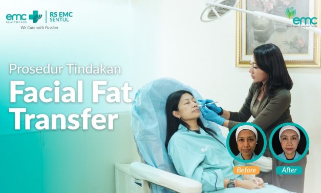 Bukan Hanya Buang Lemak, Fat Transfer Ubah Investasi Estetik