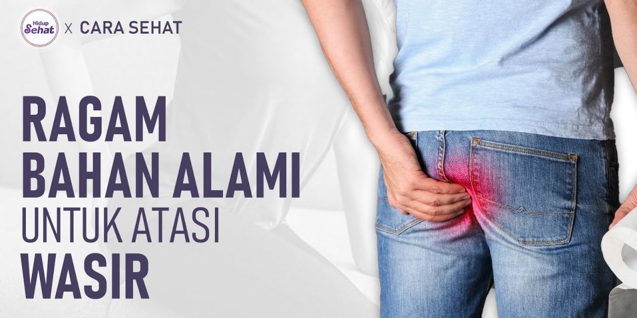 Solusi Tepat Atasi Wasir Agar Aktivitas Sehari Harimu Tetap Lancar