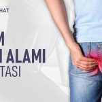Solusi Tepat Atasi Wasir Agar Aktivitas Sehari Harimu Tetap Lancar